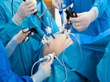 Gynae Laparoscopic Surgery